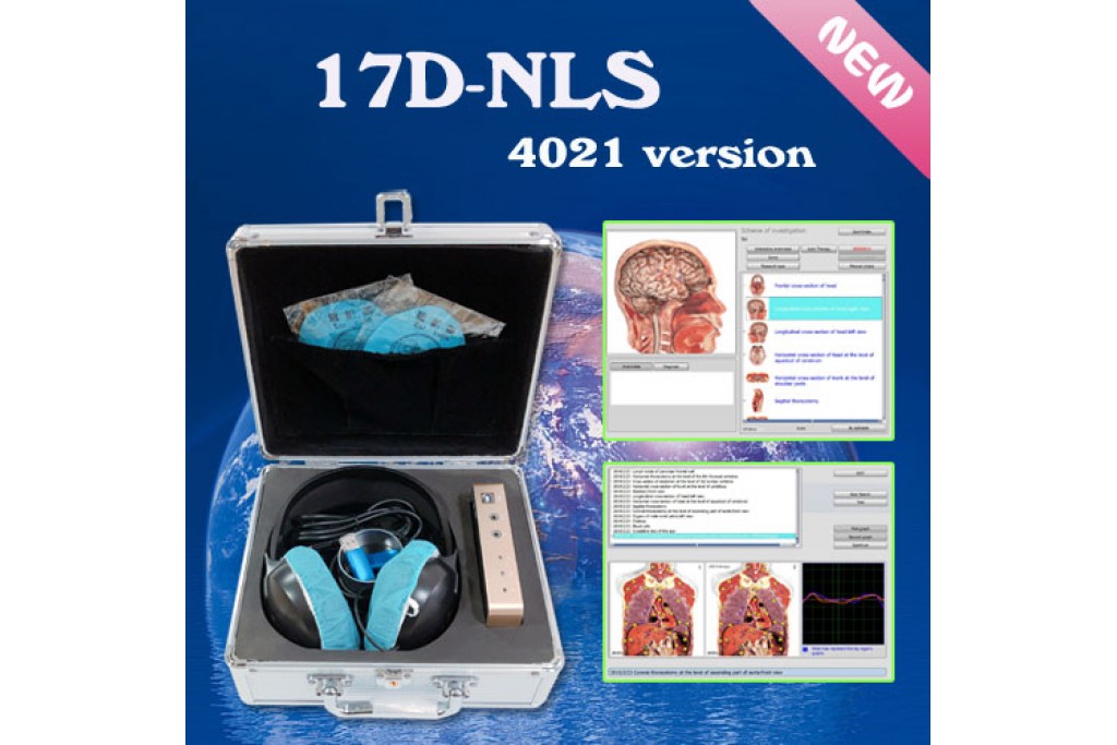 Explore NIS-17D: Opening a new journey of health management