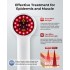 Portable Handheld Pain Relief Laser Device